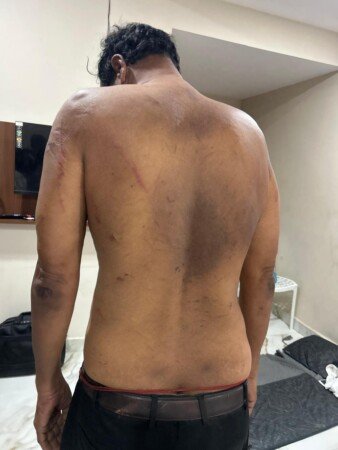 వృద్ధుడిపై దాడి ఆరోపణలుకొడుకు, కుటుంబ సభ్యులే దాడి చేశారని బాధితుడి ఫిర్యాదు
